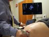 A recent study by researchers at The Ohio State University Wexner Medical Center shows pregnant women experience a dramatic decline of a protein called brain-derived neurotrophic factor (BDNF) in their last trimester, which may contribute to depression during pregnancy and low birth weights.
