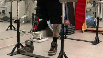 A new type of prosthetic limb snaps onto a metal bar surgically implanted into a patient’s bone, providing more stability and preventing the painful issues many people with amputations experience with traditional socket prostheses.